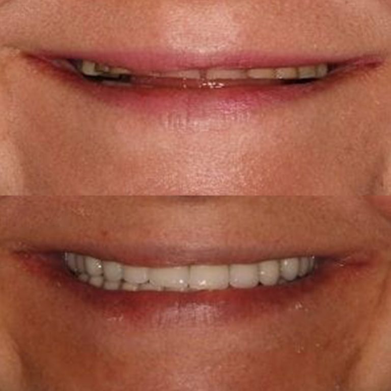 Periodontal-Procedures_1